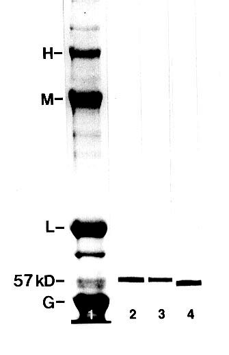 Sds+page+gel+staining