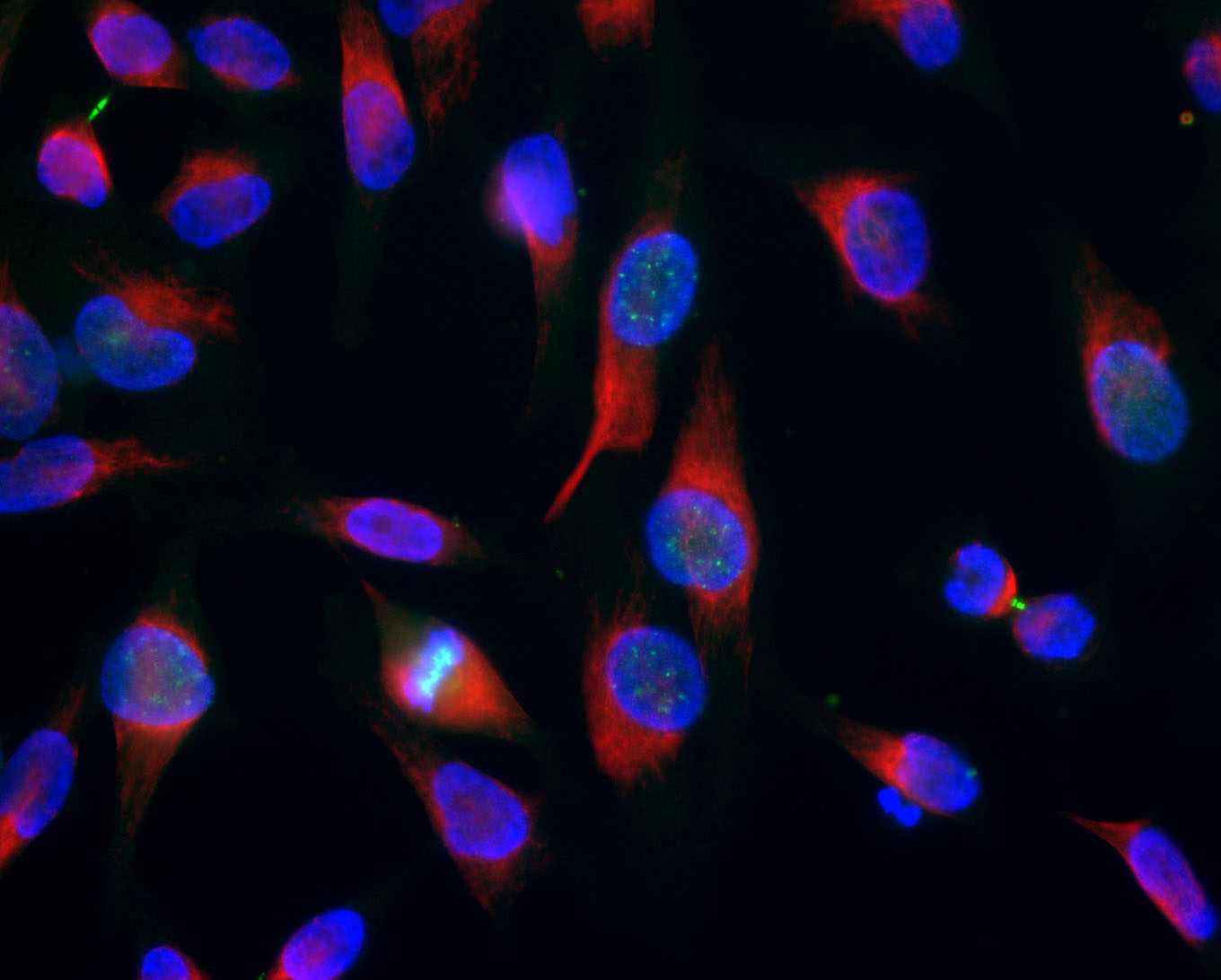 Aurora B Kinase, Mouse Monoclonal, Cat# MCA-6G2