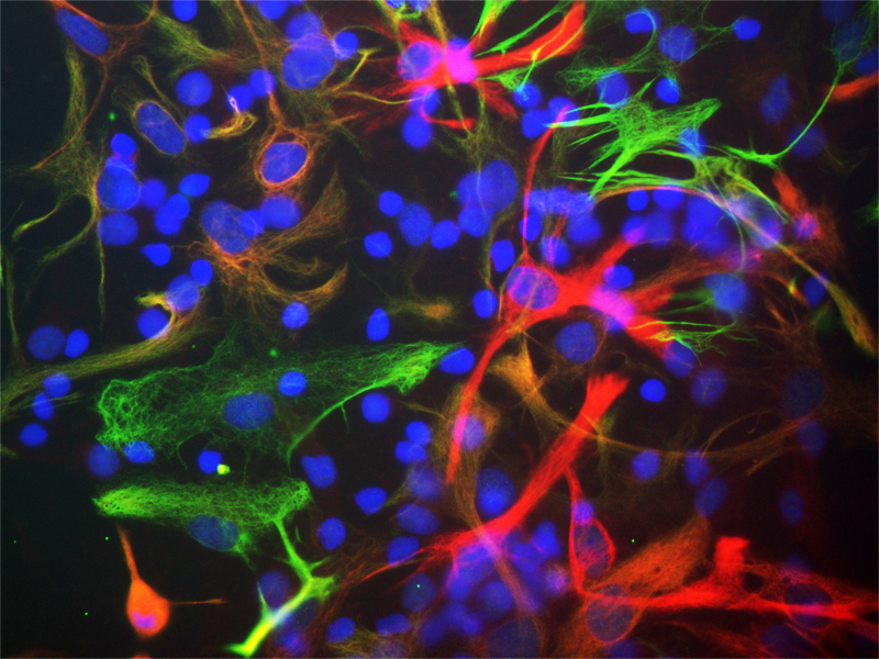 Mouse monoclonal antibody to Nestin made by EnCor Biotechnology Inc.