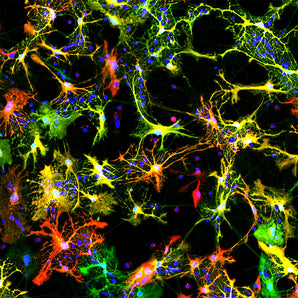 Mouse Monoclonal Antibody to Aldolase C (ALDOC, ALDC, Zebrin II), Cat# MCA-1A1