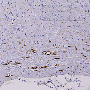 Mouse Monoclonal Antibody to Neurofilament NF-L (Nfl, NEFL) DegenoTag&trade; Peptide Cat# MCA-6H63