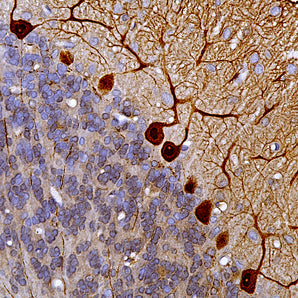 Chicken Polyclonal Antibody to Calbindin, Cat# CPCA-Calb