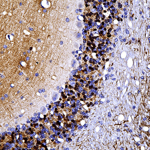 Chicken Polyclonal Antibody to Calretinin, Cat# CPCA-Calret