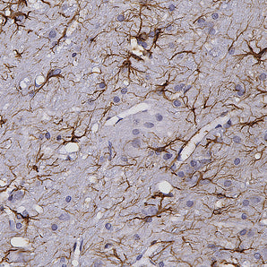 Chicken Polyclonal Antibody to Glial Fibrillary Acidic Protein (GFAP), Cat# CPCA-GFAP