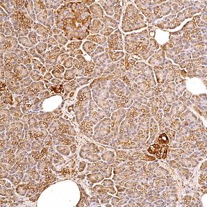Chicken Polyclonal Antibody to Heat Shock Protein 27 (HSP27), Cat# CPCA-HSP27