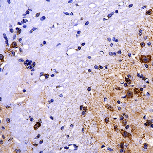 Chicken Polyclonal Antibody to Heat Shock Protein 60 (HSP60), Cat# CPCA-HSP60