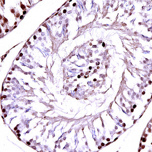 Chicken Polyclonal Antibody to Ki67 (Ki-67), Cat# CPCA-Ki67