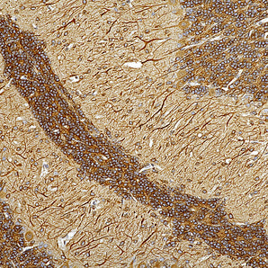 Chicken Polyclonal Antibody to Microtubule Associated Protein MAP2AB (MAP2), Cat# CPCA-MAP2