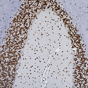 Chicken Polyclonal Antibody to Methyl-CpG Binding Protein 2 (MeCP2), Cat# CPCA-MeCP2
