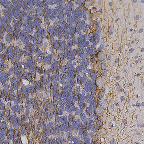 Chicken Polyclonal Antibody to NF-H (Nfh, NEFH) Cat# CPCA-NF-H