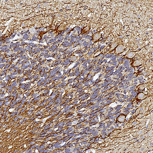 Chicken Polyclonal Antibody to Neurofilament NF-H (Nfh, NEFH), Cat# CPCA-NF-H