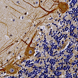 Chicken Polyclonal Antibody to Neurofilament NF-M (Nfm, NEFM), Cat# CPCA-NF-M
