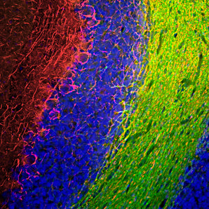 Chicken Polyclonal Antibody to Neurofilament NF-M (Nfm, NEFM) Cat# CPCA-NF-M