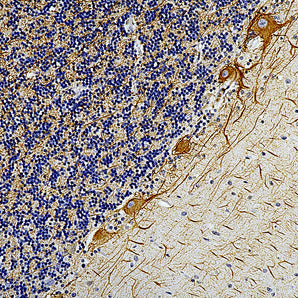 Chicken Polyclonal Antibody to Neurofilament NF-L (Nfl, NEFL), Cat# CPCA-NF-L