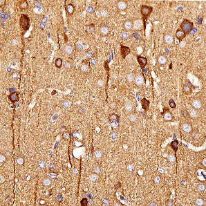 Chicken Polyclonal Antibody to Neuron Specific Enolase (NSE, ENO2, &gamma;-enolase), Cat# CPCA-NSE