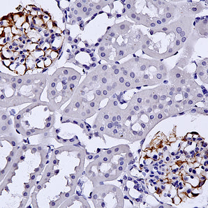 Chicken Polyclonal Antibody to Nestin, Cat# CPCA-Nestin