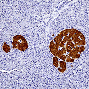 Chicken Polyclonal Antibody to Secretagogin, Cat# CPCA-SCGN