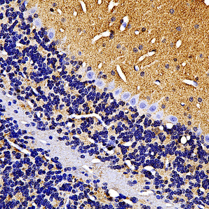 Chicken Polyclonal Antibody to α-Synuclein, Cat# CPCA-SNCA