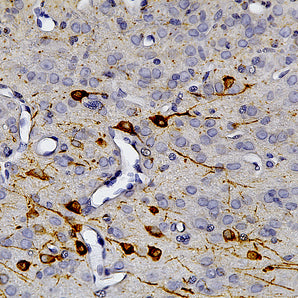 Chicken Polyclonal Antibody to Tyrosine Hydroxylase (TH), Cat# CPCA-TH