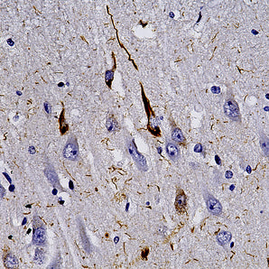 Chicken Polyclonal Antibody to Microtubule Associated Protein Tau, MAP-τ (Tau),  Cat# CPCA-Tau