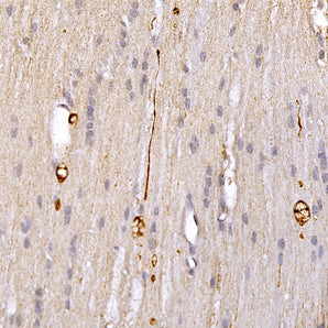 Chicken Polyclonal Antibody to Neurofilament NF-L (Nfl, NEFL) DegenoTag&trade; Peptide, Cat# CPCA-NF-L-Degen