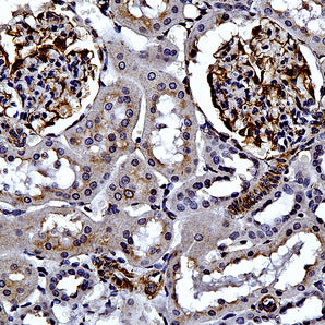 Chicken Polyclonal Antibody to Vimentin, Cat# CPCA-Vim