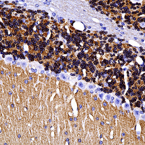 Chicken Polyclonal Antibody to Visinin Like Protein 1 (VLP1), Cat# CPCA-VLP1