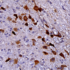 Chicken Polyclonal Antibody to mCherry, Cat# CPCA-mCherry