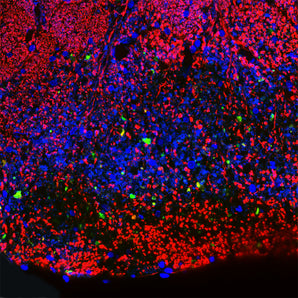Mouse Monoclonal Antibody to Neurofilament NF-L (Nfl, NEFL) DegenoTag&trade; Peptide, Cat# MCA-5H112