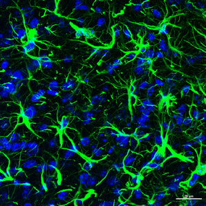 Chicken Polyclonal Antibody to GFAP Cat# CPCA-GFAP