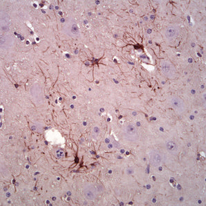 Mouse Monoclonal Antibody to GFAP (GFAP) Cat# MCA-5C10