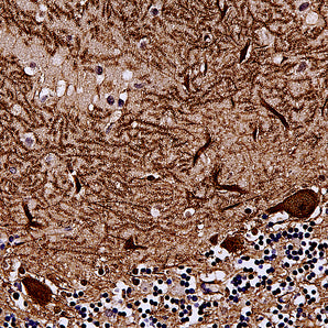 Mouse Monoclonal Antibody to Aldolase C (ALDOC, ALDC, Zebrin II), Cat# MCA-1A1