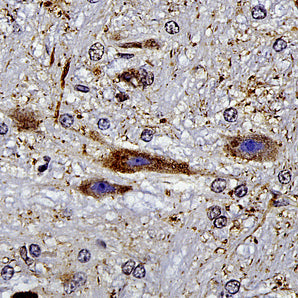Mouse Monoclonal Antibody to mCherry, Cat# MCA-1C51