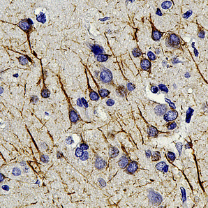 Mouse Monoclonal Antibody to α-Internexin/NF66, Cat# MCA-1D2