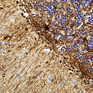 Mouse Monoclonal Antibody to Glial Fibrillary Acidic Protein-Human (GFAP), Cat# MCA-2A5