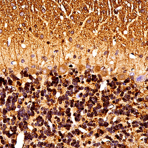 Mouse Monoclonal Antibody to α-Synuclein, Cat# MCA-2A7