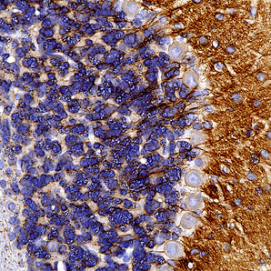 Mouse Monoclonal Antibody to Ankyrin 3/Ankyrin G, Cat# MCA-2A8