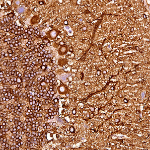 Mouse Monoclonal Antibody to Microtubule Associated Protein MAP2ABCD (MAP2), Cat# MCA-2C4