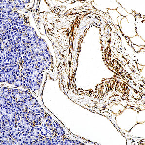 Mouse Monoclonal Antibody to Vimentin, Cat# MCA-2D1