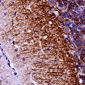 Mouse Monoclonal Antibody to α-Internexin/NF66, Cat# MCA-2E3