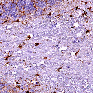 Mouse Monoclonal Antibody to Aldehyde Dehydrogenase 1 Family Member L1 (ALDH1L1), Cat# MCA-2E7