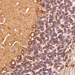 Mouse Monoclonal Antibody to Microtubule Associated Protein Tau, MAP-τ (Tau), Cat# MCA-2E9
