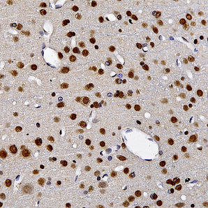 Mouse Monoclonal Antibody to Nuclear Pore Complex, Cat# MCA-39C7