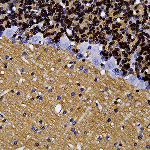 Mouse Monoclonal Antibody to Visinin Like Protein 1 (VLP1), Cat# MCA-3A9