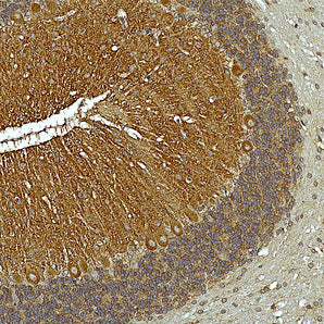 Mouse Monoclonal Antibody to αII-Spectrin Cat# MCA-3D7