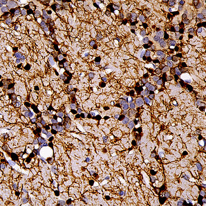 Mouse Monoclonal Antibody to Calretinin, Cat# MCA-3G9