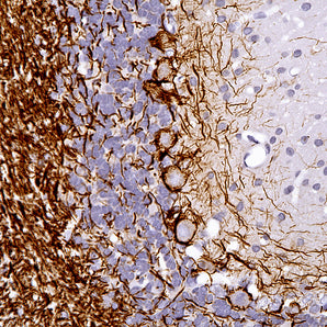 Mouse Monoclonal Antibody to Neurofilament NF-M (Nfm, NEFM), Cat# MCA-3H11
