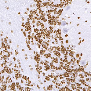 Mouse Monoclonal Antibody to Transactivation Response Binding Protein 43 (TDP43, TARDBP, ALS10), Cat# MCA-3H8