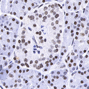 Mouse Monoclonal Antibody to Fibrillarin, Cat# MCA-4A4