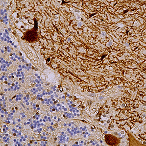 Mouse Monoclonal Antibody to Aldolase C (ALDOC, ALDC, Zebrin II), Cat# MCA-4A9